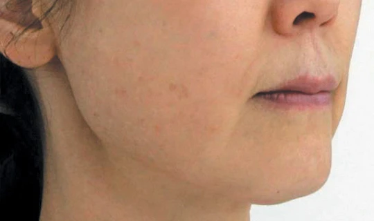 Oligio Клиника эстетической медицины – в г. Липецк