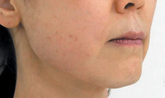 Oligio Клиника эстетической медицины – в г. Липецк