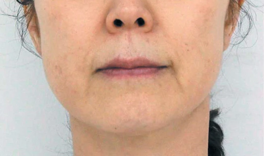 Oligio Клиника эстетической медицины – в г. Липецк