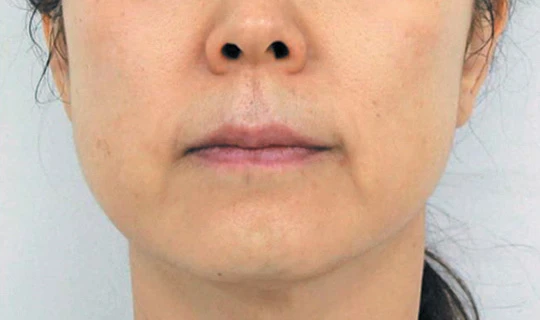 Oligio Клиника эстетической медицины – в г. Липецк