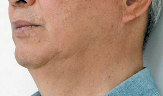 Oligio Клиника эстетической медицины – в г. Липецк