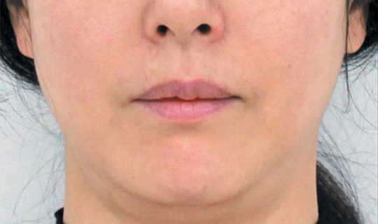 Oligio Клиника эстетической медицины – в г. Липецк