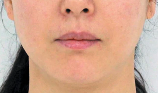 Oligio Клиника эстетической медицины – в г. Липецк